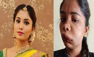 Saranya Sexy Xxx Videos - Shocking! Actress Swathi Sathish face disfigured after wrong medical  procedure - Tamil News - IndiaGlitz.com